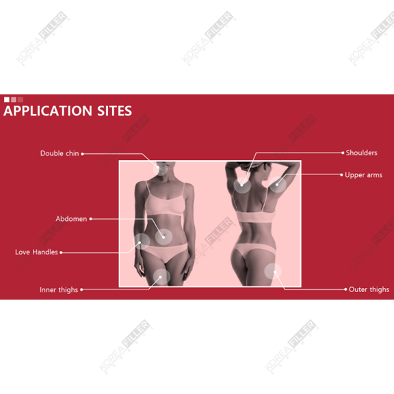 Kabelline - Image 4