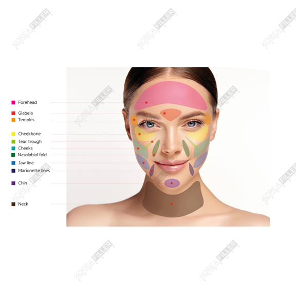 AestheFill 200mg - Image 3