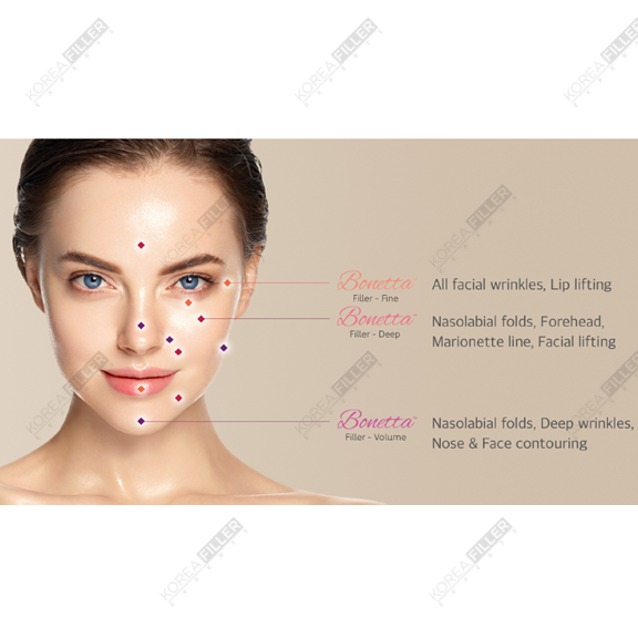 Bonetta - Image 5
