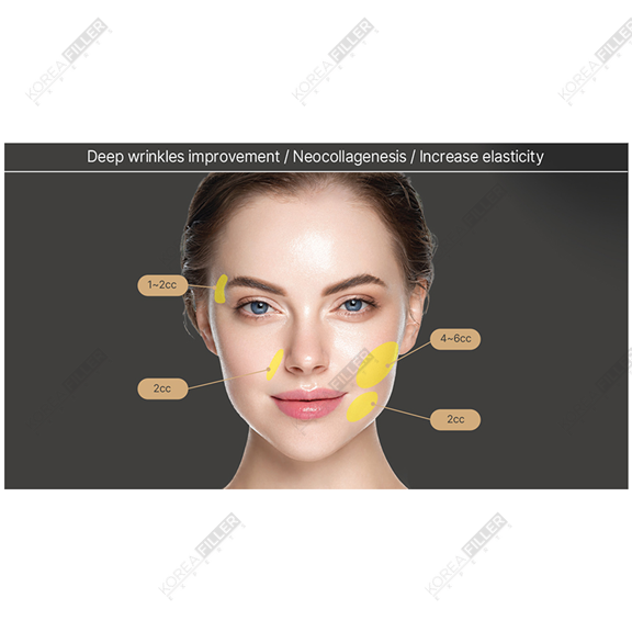 Etrebelle 200mg - Image 3