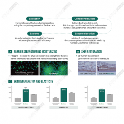 Exoluma – 1 Box (5 Sets) - Image 4